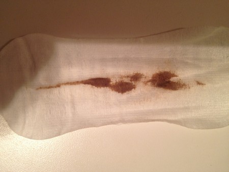 фото коричневой мазни после месячных