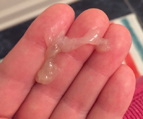 Слизь во время овуляции