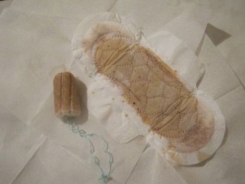 светло-коричневые выделения фото