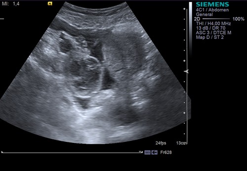 как проводится процедура