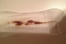 бурые выделения на прокладке фото