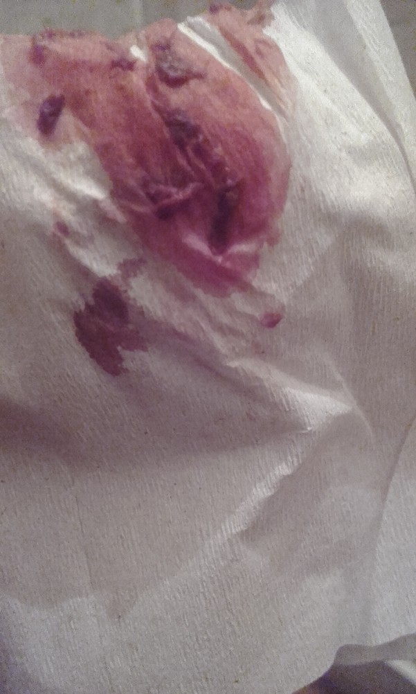 светлые месячные на салфетке фото