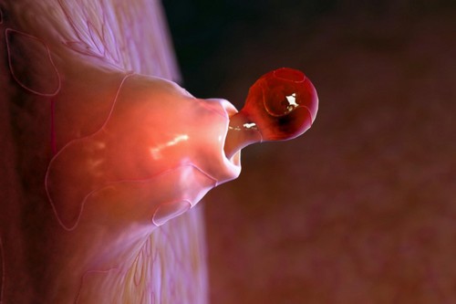 яйцеклктка выходит из фолликула