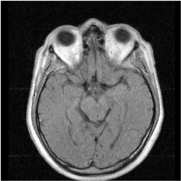 головной мозг