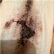 Черные месячные на прокладке фото