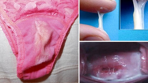 белесые выделения из влагалища