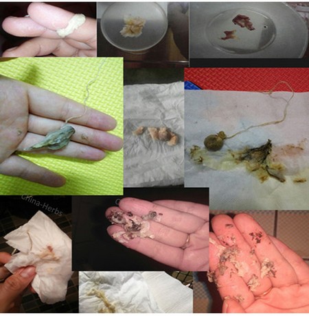 Фото китайских тампонов после испольования