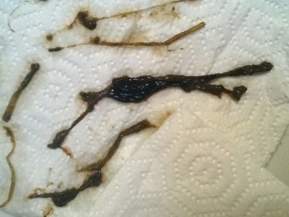 темные выделения