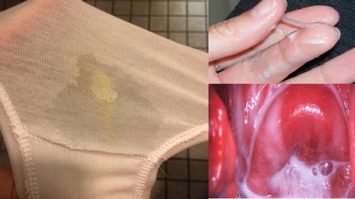 Белые выделения у девушки с запахом фото