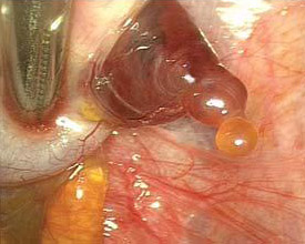 выход яйцеклетки