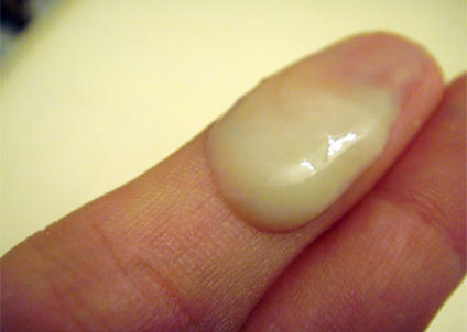 Желтый цвет влагалищных выделений при беременности