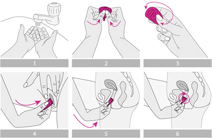 схема введения