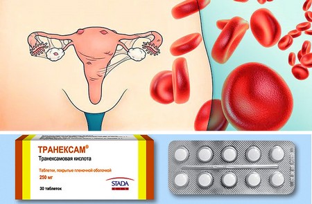 Как принимаит препарат при обильных месячных