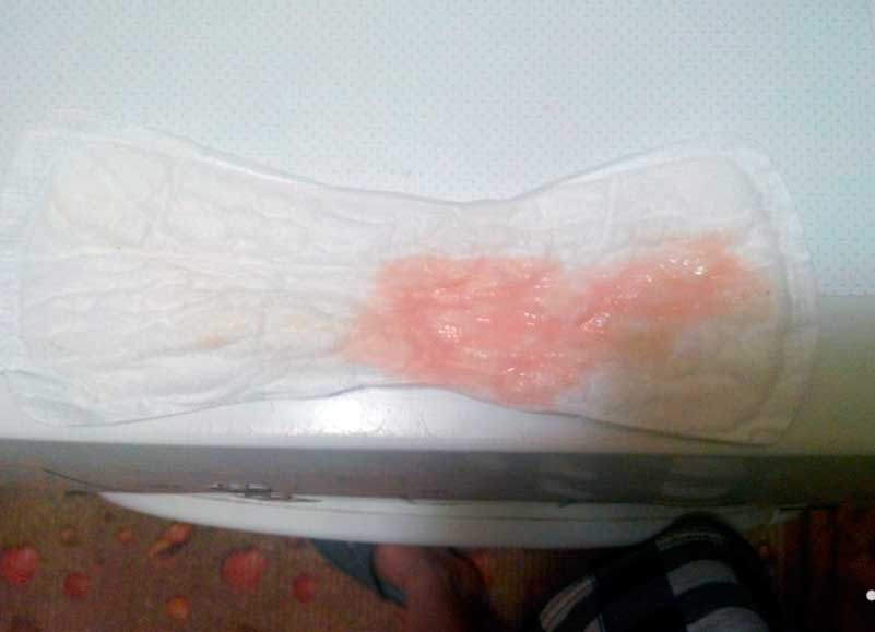 розовые перед месячными